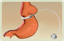 γλίστρημα δακτυλίου